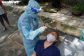 xet-nghiem-go-vap-9-13431765