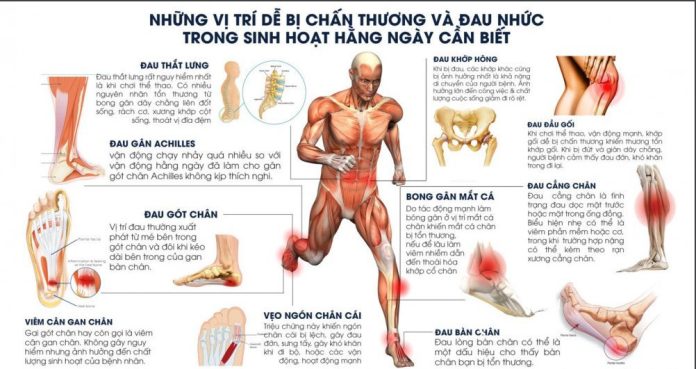 Những chấn thương thể thao thường xuyên gặp phải