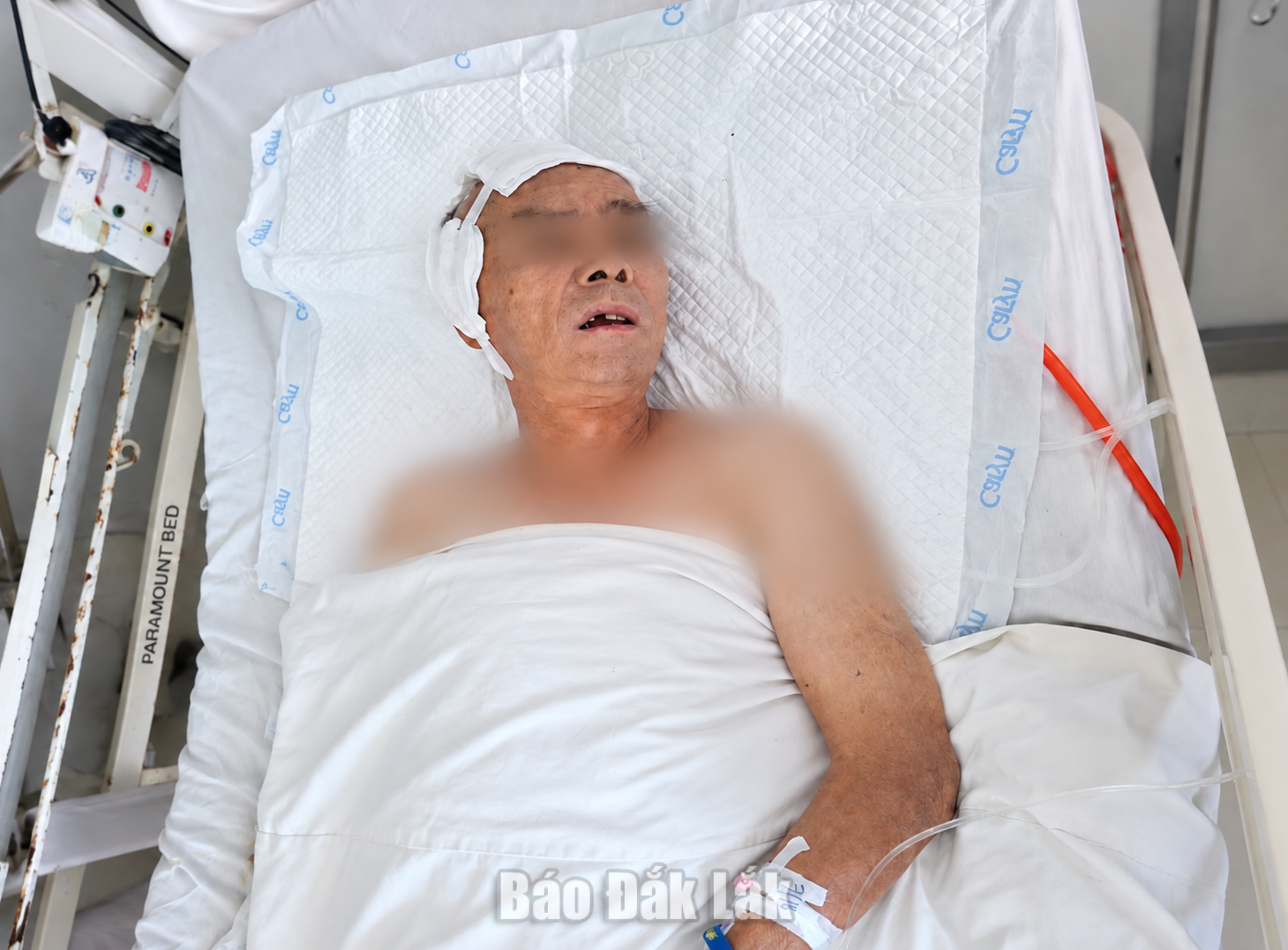 Bệnh nhân chấn thương sọ não nặng được các bác sĩ Bệnh viện Đa khoa vùng Tây Nguyên cứu sống sau phẫu thuật cấp cứu và điều trị tích cực.